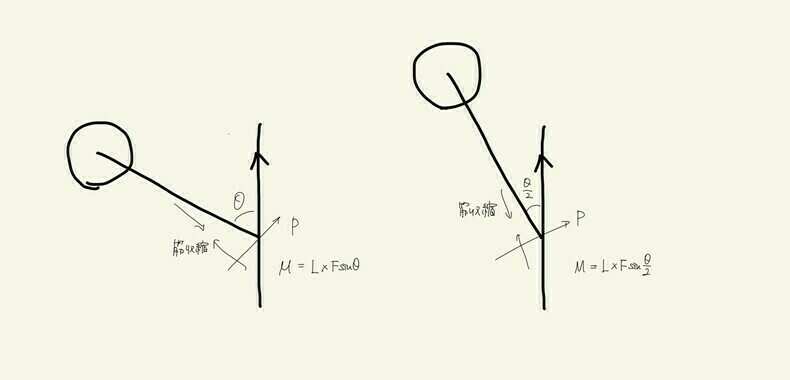 くしゃみをしてぎっくり腰-図5JCC池袋整体
